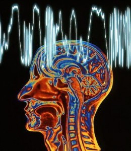 Epilepsy: MRI brain scan and EEG trace